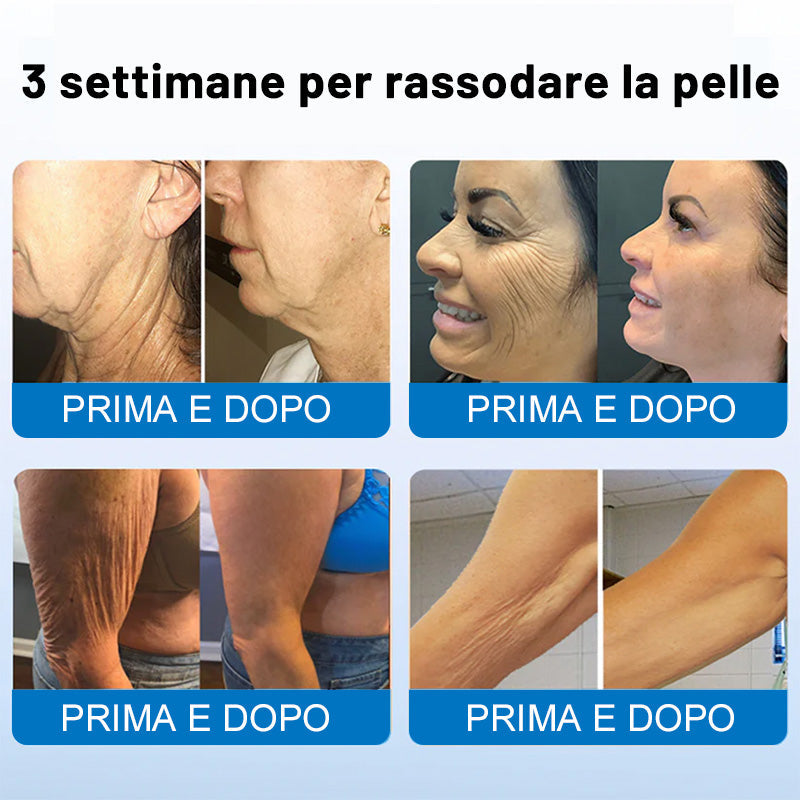 😍✨Furzero® Oligopeptide-Infused Skin Firming Cream