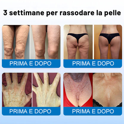 😍✨Furzero® Oligopeptide-Infused Skin Firming Cream