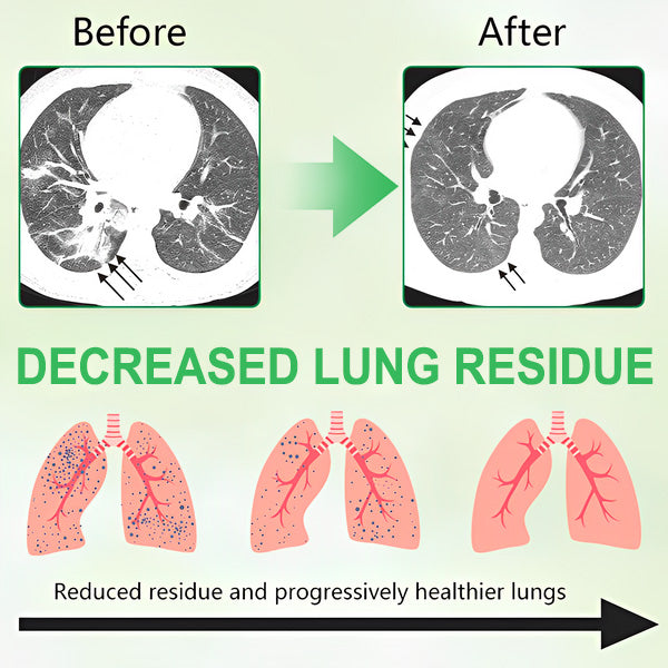 😍💫GFOUK®3X Concentrated Mullein Lung Cleanse Drops —Difficulty coughing up phlegm, shortness of breath, excessive mucus, bronchitis, and lung infections