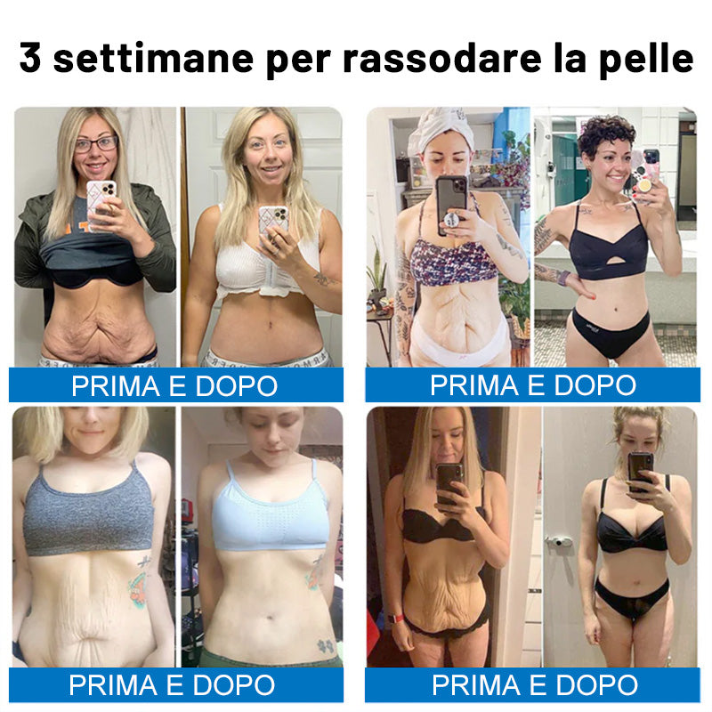 😍✨Furzero® Oligopeptide-Infused Skin Firming Cream