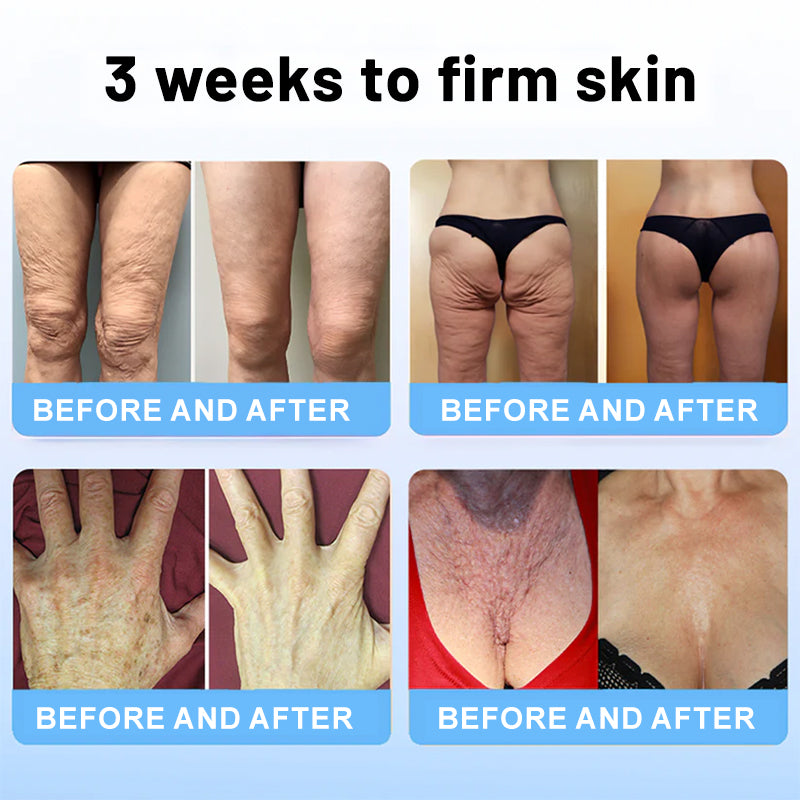 😍✨Flysmus™ Collagen Peptides  FIRMING SERUM STICK