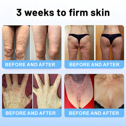 😍✨Flysmus™ Collagen Peptides  FIRMING SERUM STICK